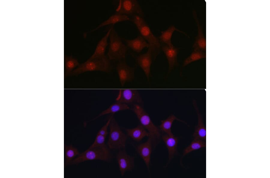 Immunofluorescence - Anti-C9orf72 Antibody (A90409) - Antibodies.com