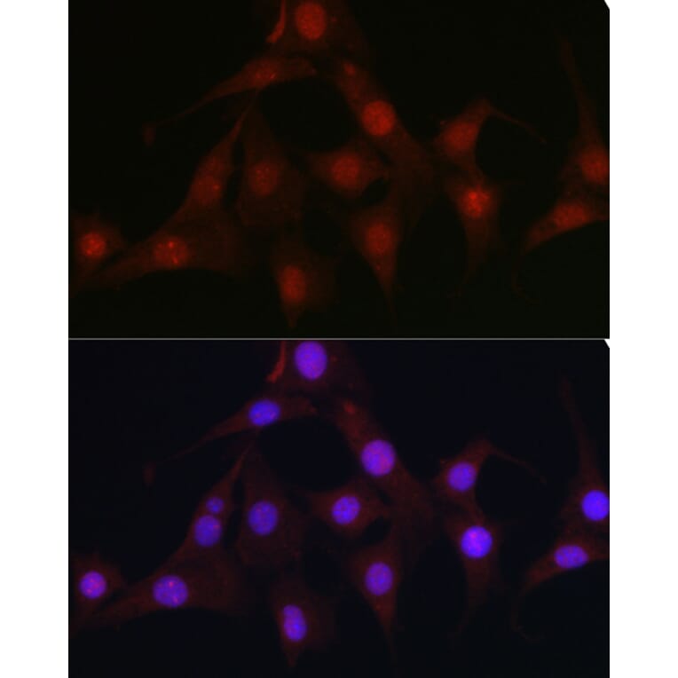 Immunofluorescence - Anti-C9orf72 Antibody (A90409) - Antibodies.com