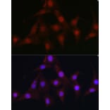 Immunofluorescence - Anti-C9orf72 Antibody (A90409) - Antibodies.com