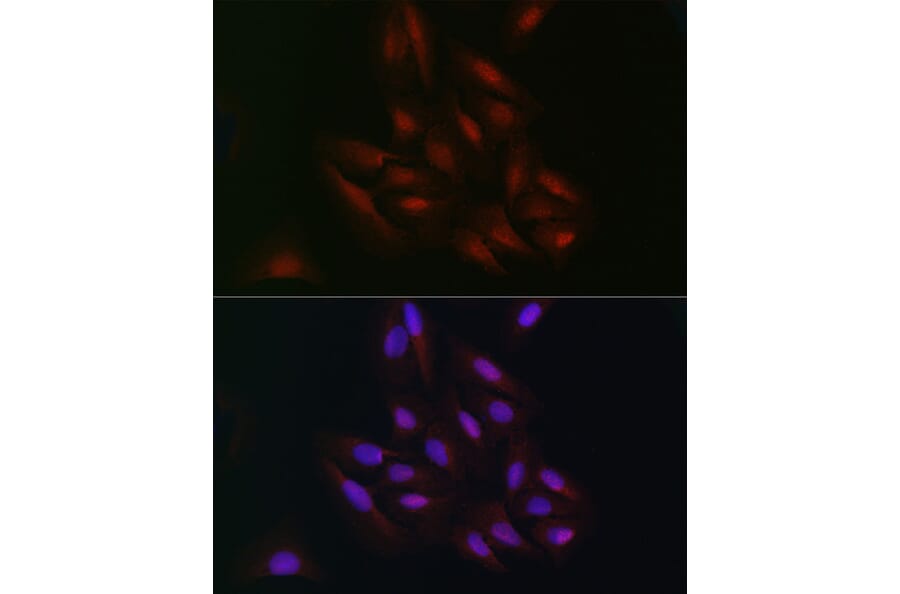 Immunofluorescence - Anti-C9orf72 Antibody (A90409) - Antibodies.com