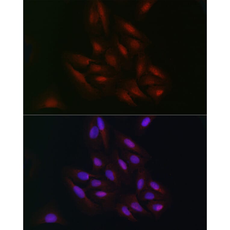 Immunofluorescence - Anti-C9orf72 Antibody (A90409) - Antibodies.com