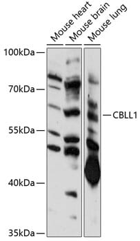 Western blot analysis of extracts of various cell lines, using Anti-CBLL1 Antibody (A14932) at 1:1,000 dilution.
Secondary antibody: Goat Anti-Rabbit IgG (H+L) (HRP) (AS014) at 1:10,000 dilution.
Lysates / proteins: 25µg per lane.
Blocking buffer: 3% non-fat dry milk in TBST.
Detection: ECL Basic Kit (RM00020).
Exposure time: 90s.