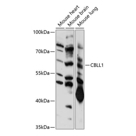 Western Blot - Anti-CBLL1 Antibody (A90410) - Antibodies.com