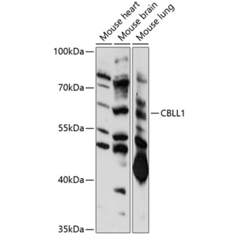 Western Blot - Anti-CBLL1 Antibody (A90410) - Antibodies.com
