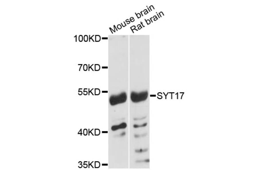 Western Blot - Anti-SYT17 Antibody (A4764) - Antibodies.com