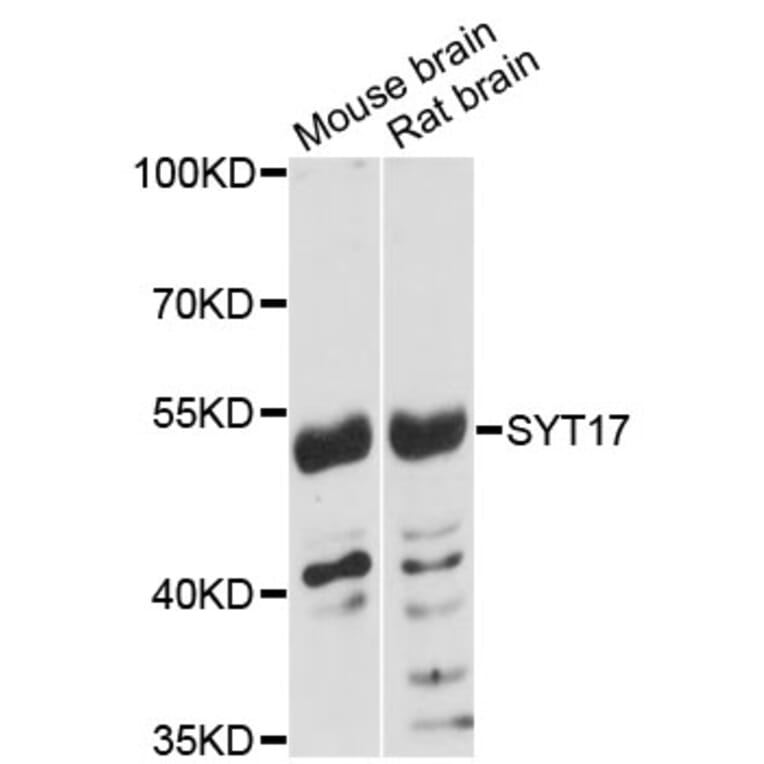 Western Blot - Anti-SYT17 Antibody (A4764) - Antibodies.com