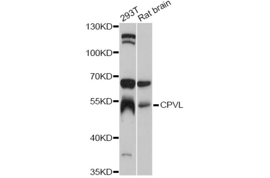 Western Blot - Anti-CPVL Antibody (A12370) - Antibodies.com