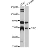 Western Blot - Anti-CPVL Antibody (A12370) - Antibodies.com