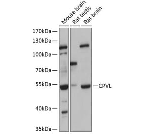 Western Blot - Anti-CPVL Antibody (A90413) - Antibodies.com