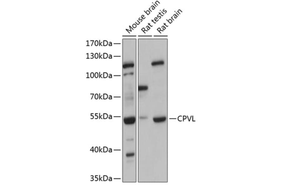 Western Blot - Anti-CPVL Antibody (A90413) - Antibodies.com