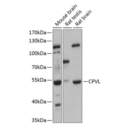 Western Blot - Anti-CPVL Antibody (A90413) - Antibodies.com
