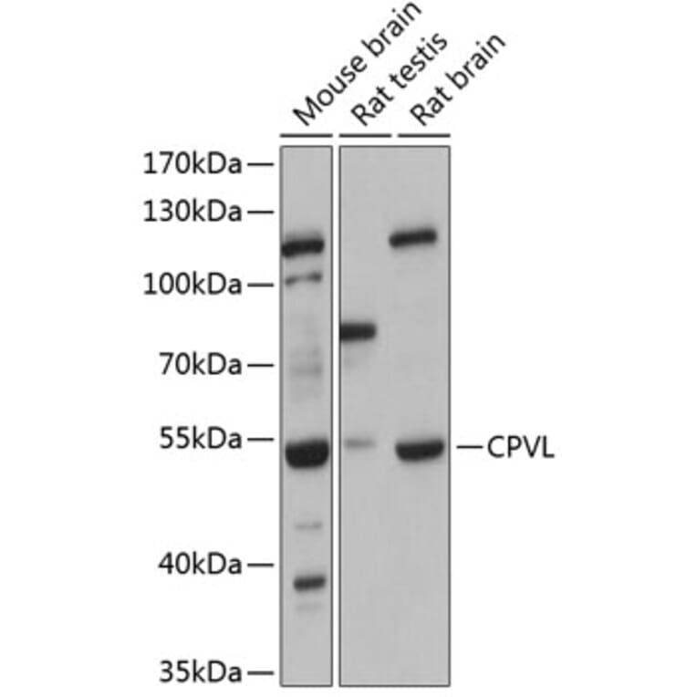 Western Blot - Anti-CPVL Antibody (A90413) - Antibodies.com