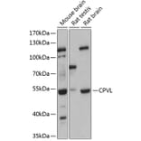 Western Blot - Anti-CPVL Antibody (A90413) - Antibodies.com