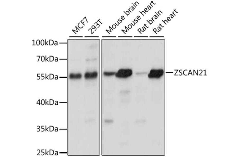Western Blot - Anti-ZSCAN21 Antibody (A90414) - Antibodies.com