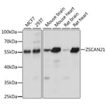 Western Blot - Anti-ZSCAN21 Antibody (A90414) - Antibodies.com