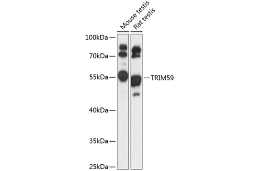 Western Blot - Anti-TRIM59 Antibody (A90415) - Antibodies.com