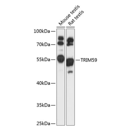 Western Blot - Anti-TRIM59 Antibody (A90415) - Antibodies.com