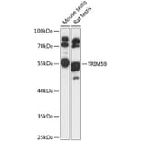 Western Blot - Anti-TRIM59 Antibody (A90415) - Antibodies.com