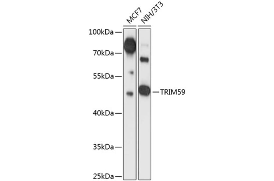 Western Blot - Anti-TRIM59 Antibody (A90415) - Antibodies.com
