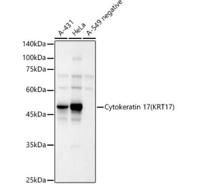 Western Blot - Anti-Cytokeratin 17 Antibody (A90416) - Antibodies.com