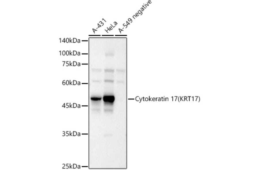 Western Blot - Anti-Cytokeratin 17 Antibody (A90416) - Antibodies.com
