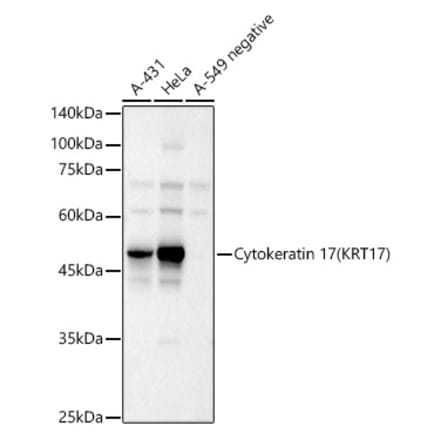 Western Blot - Anti-Cytokeratin 17 Antibody (A90416) - Antibodies.com