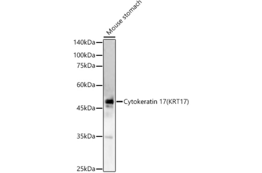 Western Blot - Anti-Cytokeratin 17 Antibody (A90416) - Antibodies.com