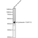 Western Blot - Anti-Cytokeratin 17 Antibody (A90416) - Antibodies.com