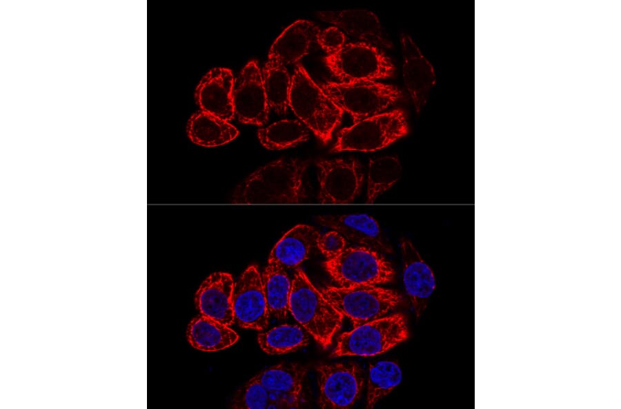 Immunofluorescence - Anti-Cytokeratin 17 Antibody (A90416) - Antibodies.com