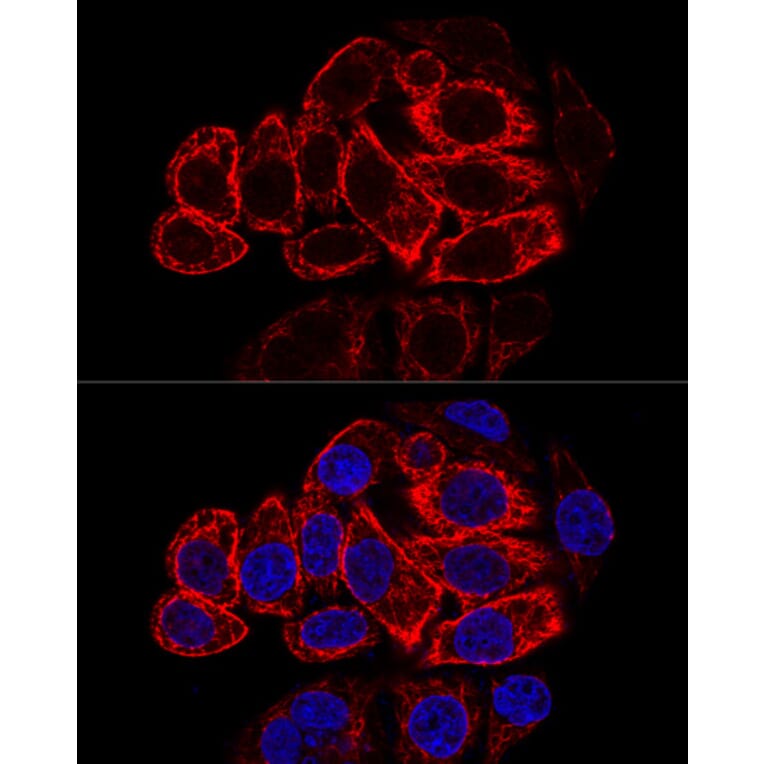 Immunofluorescence - Anti-Cytokeratin 17 Antibody (A90416) - Antibodies.com