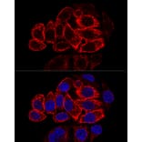 Immunofluorescence - Anti-Cytokeratin 17 Antibody (A90416) - Antibodies.com