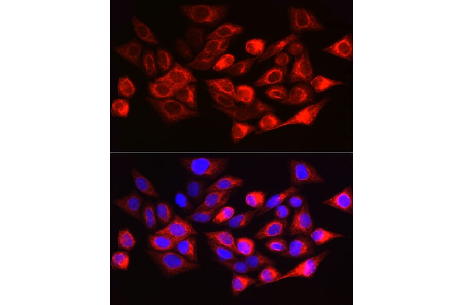 Immunofluorescence - Anti-Cytokeratin 17 Antibody (A90416) - Antibodies.com
