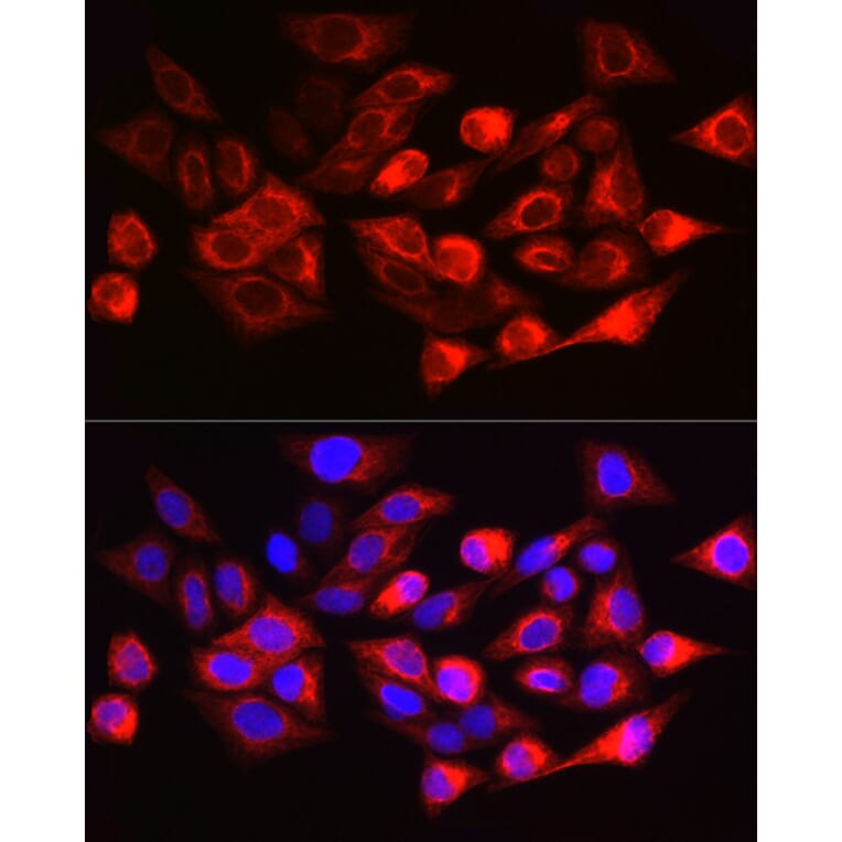 Immunofluorescence - Anti-Cytokeratin 17 Antibody (A90416) - Antibodies.com