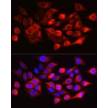 Immunofluorescence - Anti-Cytokeratin 17 Antibody (A90416) - Antibodies.com