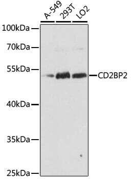Western blot analysis of extracts of various cell lines, using Anti-CD2BP2 Antibody (A15777) at 1:1,000 dilution.
Secondary antibody: Goat Anti-Rabbit IgG (H+L) (HRP) (AS014) at 1:10,000 dilution.
Lysates / proteins: 25µg per lane.
Blocking buffer: 3% non-fat dry milk in TBST.
Detection: ECL Basic Kit (RM00020).
Exposure time: 60s.