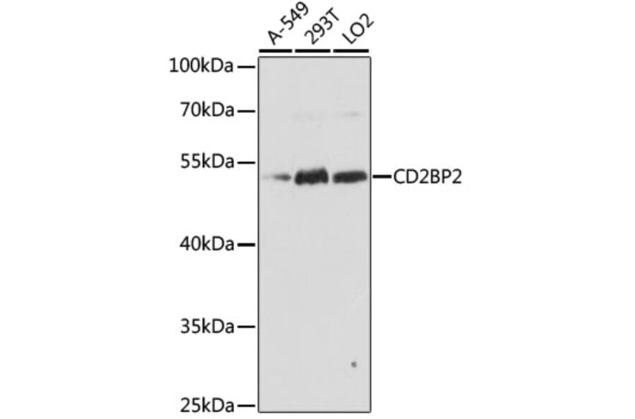 Western Blot - Anti-CD2BP2 Antibody (A90417) - Antibodies.com