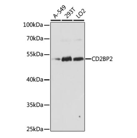 Western Blot - Anti-CD2BP2 Antibody (A90417) - Antibodies.com