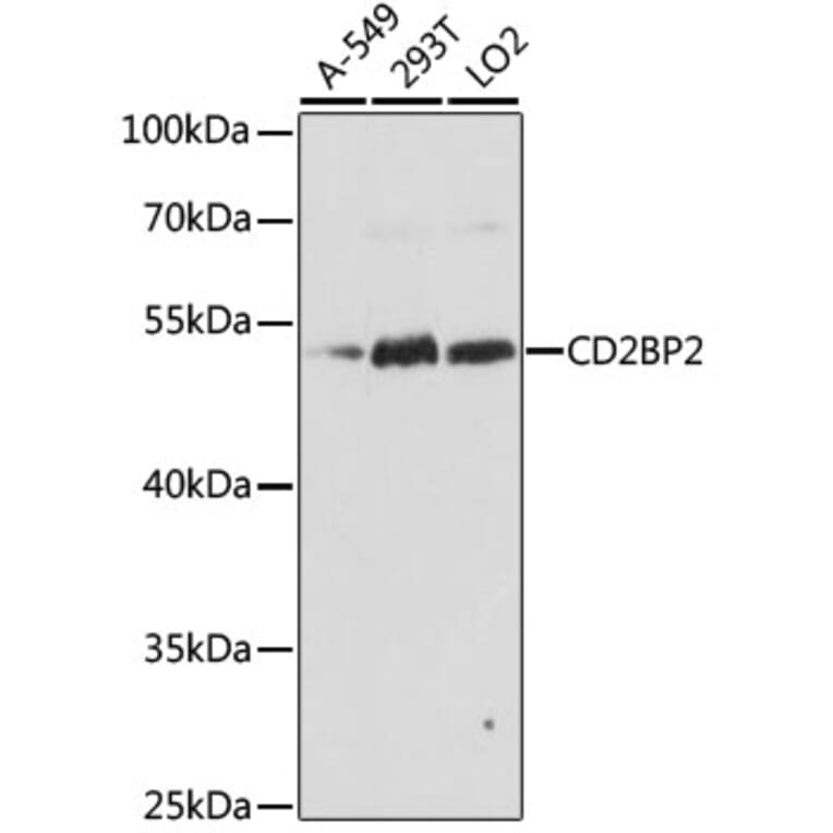 Western Blot - Anti-CD2BP2 Antibody (A90417) - Antibodies.com