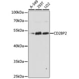 Western Blot - Anti-CD2BP2 Antibody (A90417) - Antibodies.com