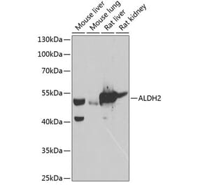 Western Blot - Anti-ALDH2 Antibody (A90419) - Antibodies.com
