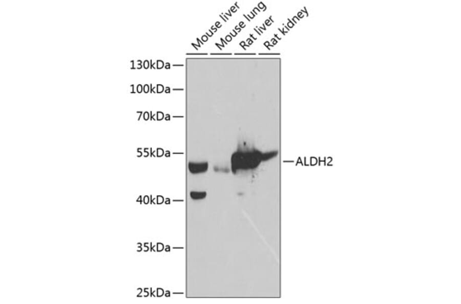 Western Blot - Anti-ALDH2 Antibody (A90419) - Antibodies.com