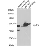 Western Blot - Anti-ALDH2 Antibody (A90419) - Antibodies.com