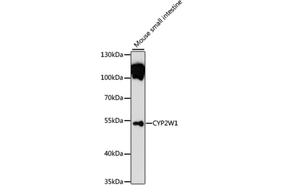 Western Blot - Anti-CYP2W1 Antibody (A13762) - Antibodies.com