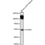 Western Blot - Anti-CYP2W1 Antibody (A13762) - Antibodies.com