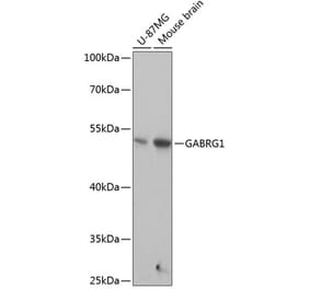 Western Blot - Anti-GABA A Receptor gamma 1 Antibody (A90423) - Antibodies.com
