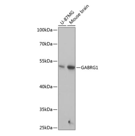 Western Blot - Anti-GABA A Receptor gamma 1 Antibody (A90423) - Antibodies.com