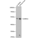 Western Blot - Anti-GABA A Receptor gamma 1 Antibody (A90423) - Antibodies.com