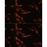 Immunofluorescence - Anti-GABA A Receptor gamma 1 Antibody (A90423) - Antibodies.com