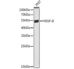 Western Blot - Anti-VEGFD Antibody (A90424) - Antibodies.com