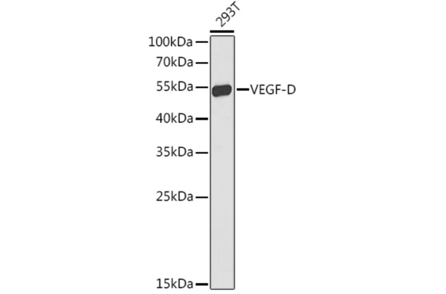 Western Blot - Anti-VEGFD Antibody (A90424) - Antibodies.com